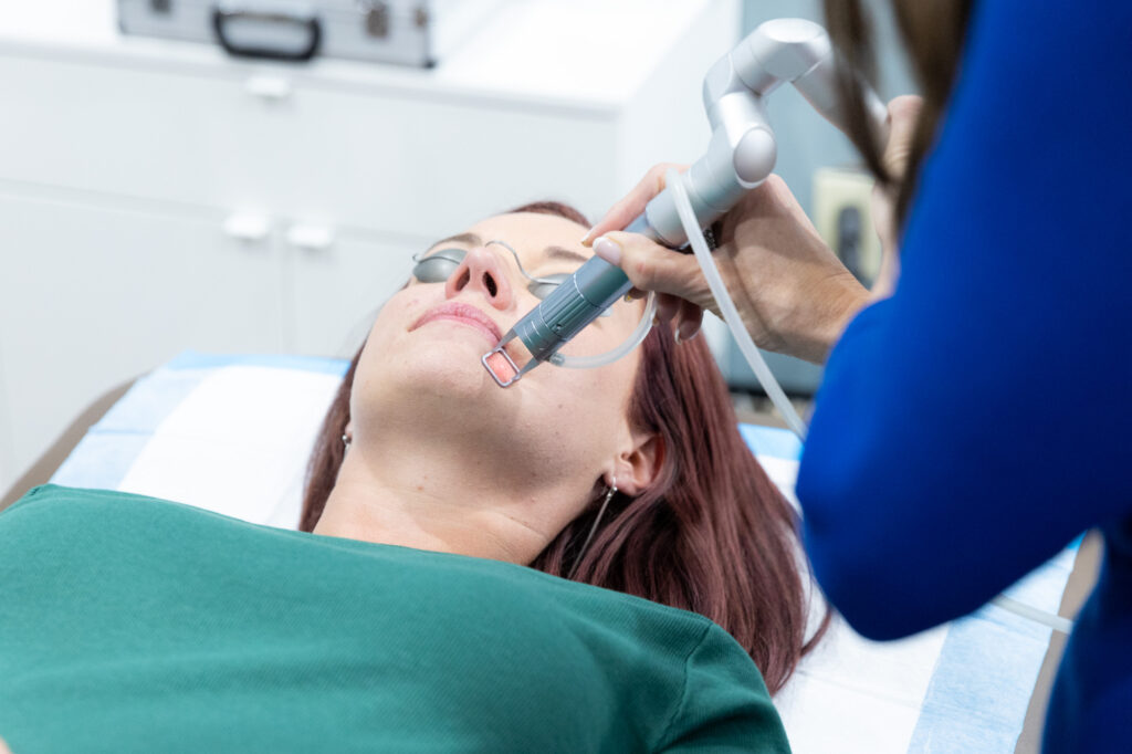 Close up of a woman receiving laser skin resurfacing in Mason, OH. 