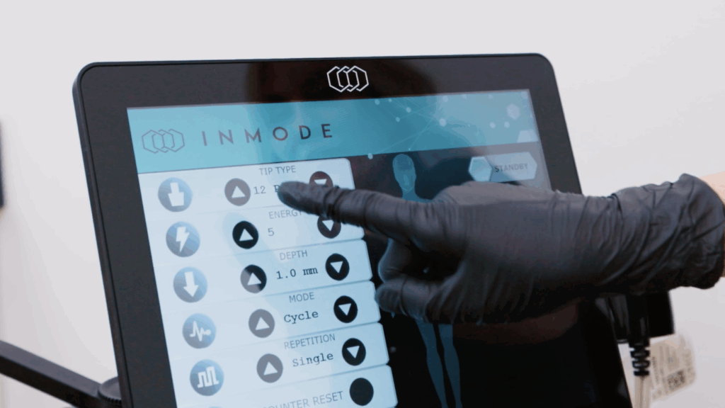 Close up of a gloved hand operating the digital control screen for Morpheus8, one of our best options for cellulite treatment in Cincinnati.