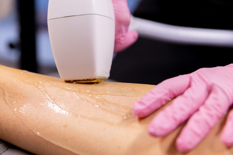 Close up of Laser hair removal in Mason as gloved hands glide the sleek device along a patients skin.
